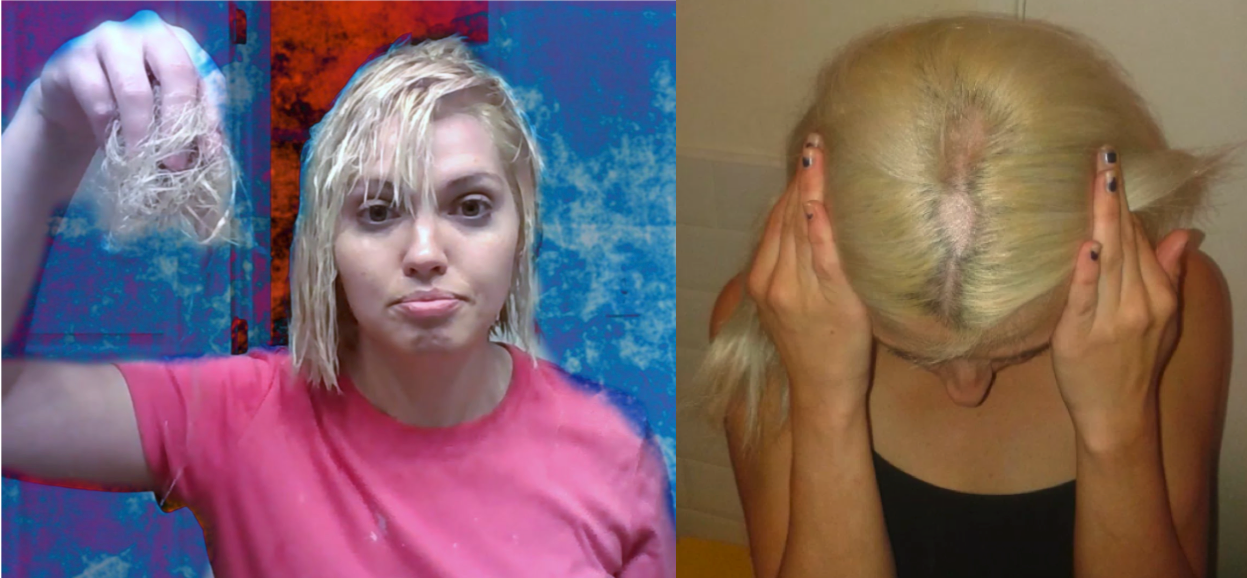 15 Pics Of Hair Bleach Gone Very Wrong Thetalko