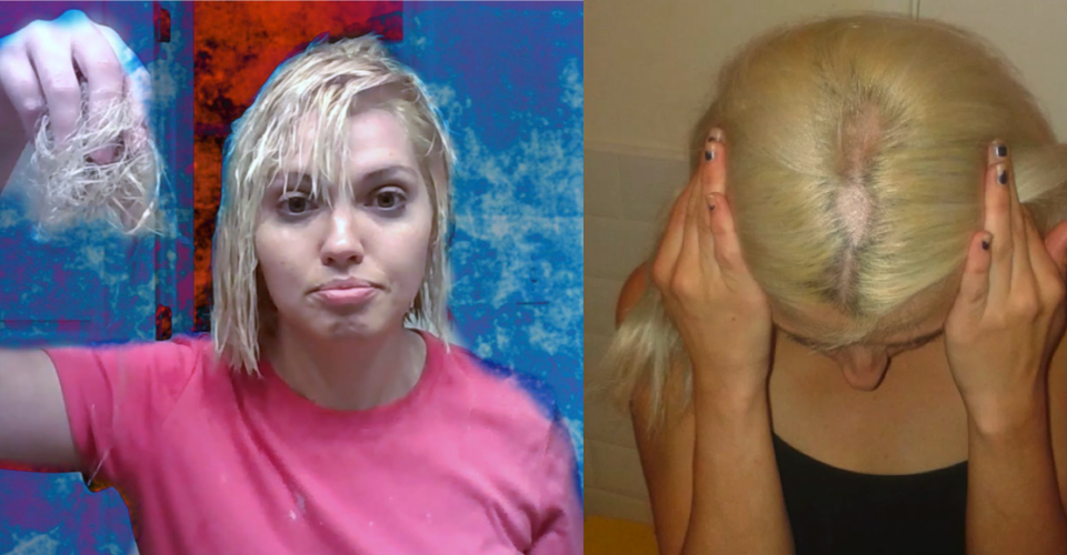 Over bleached hair breaking off