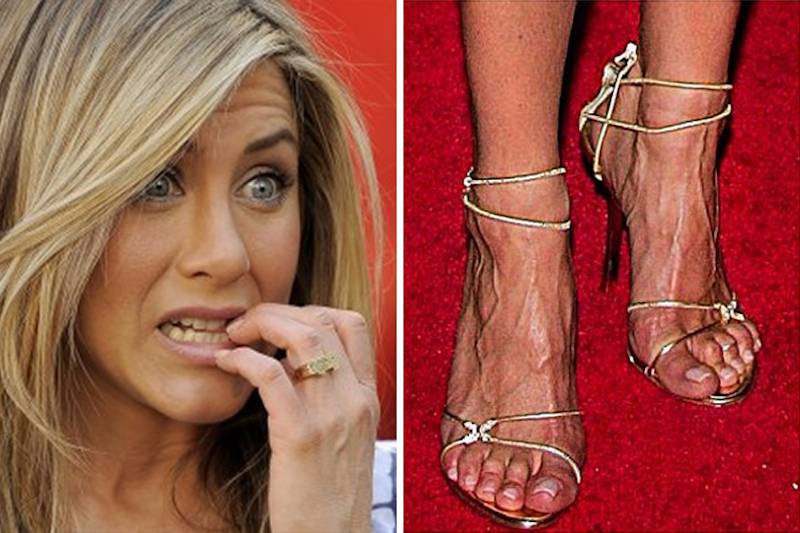 Celebrities with pretty feet